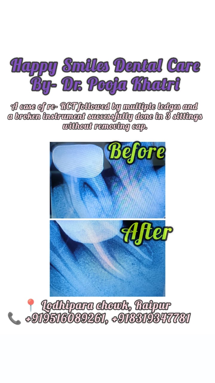 Dental Treatment Result